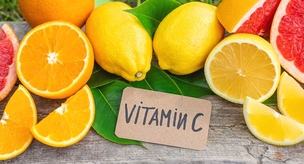 Vitamin C rich foods including oranges, lemons and kiwifruit